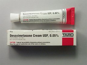 Desoximetasone Topical