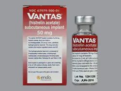 Vantas (Generic Histrelin Implant)